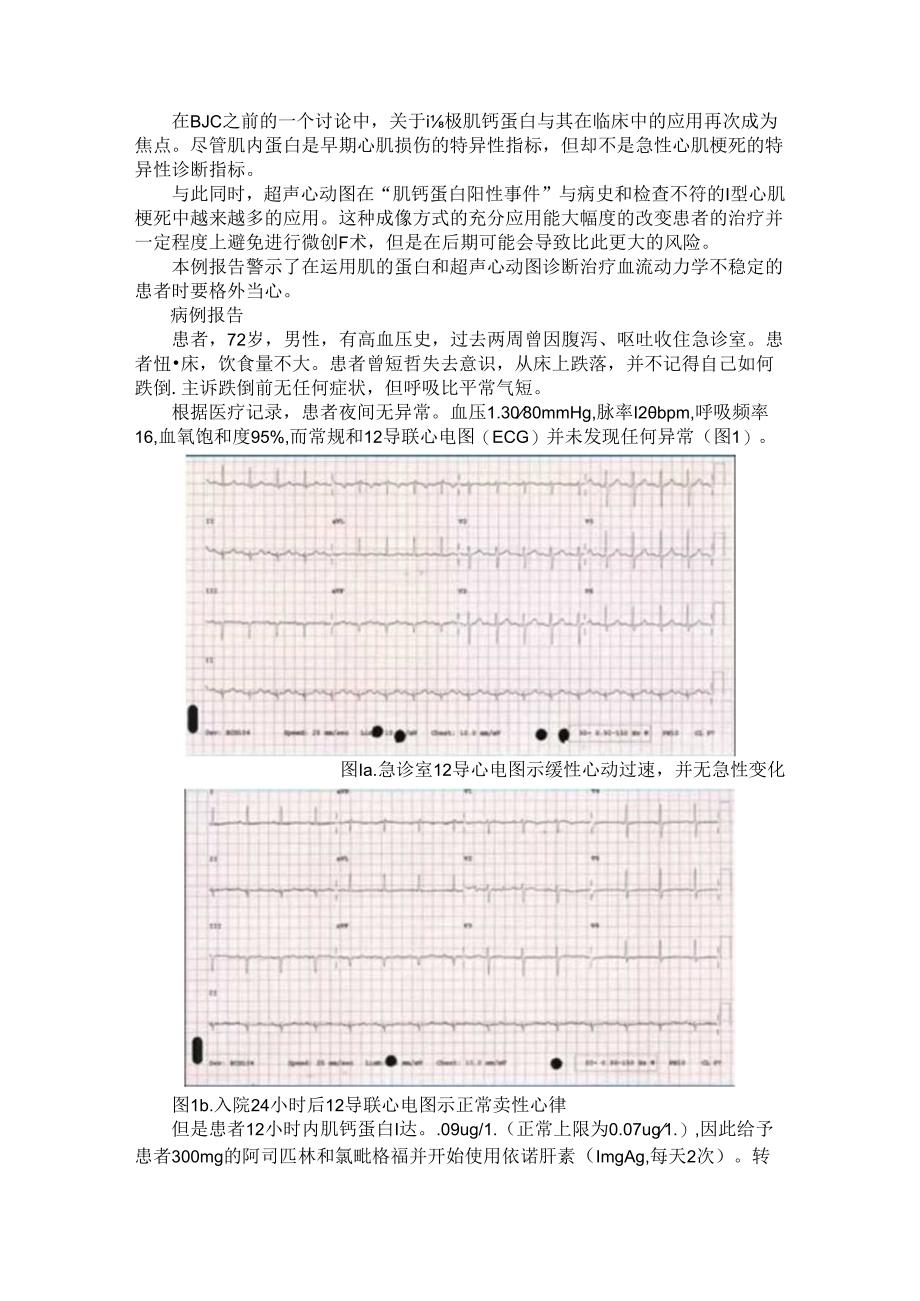 超声心动图排除非ST段抬高型心肌梗死（心脏超声造影诊断非ST段抬高型心肌梗死患者梗死相关血管的应用）.docx_第1页