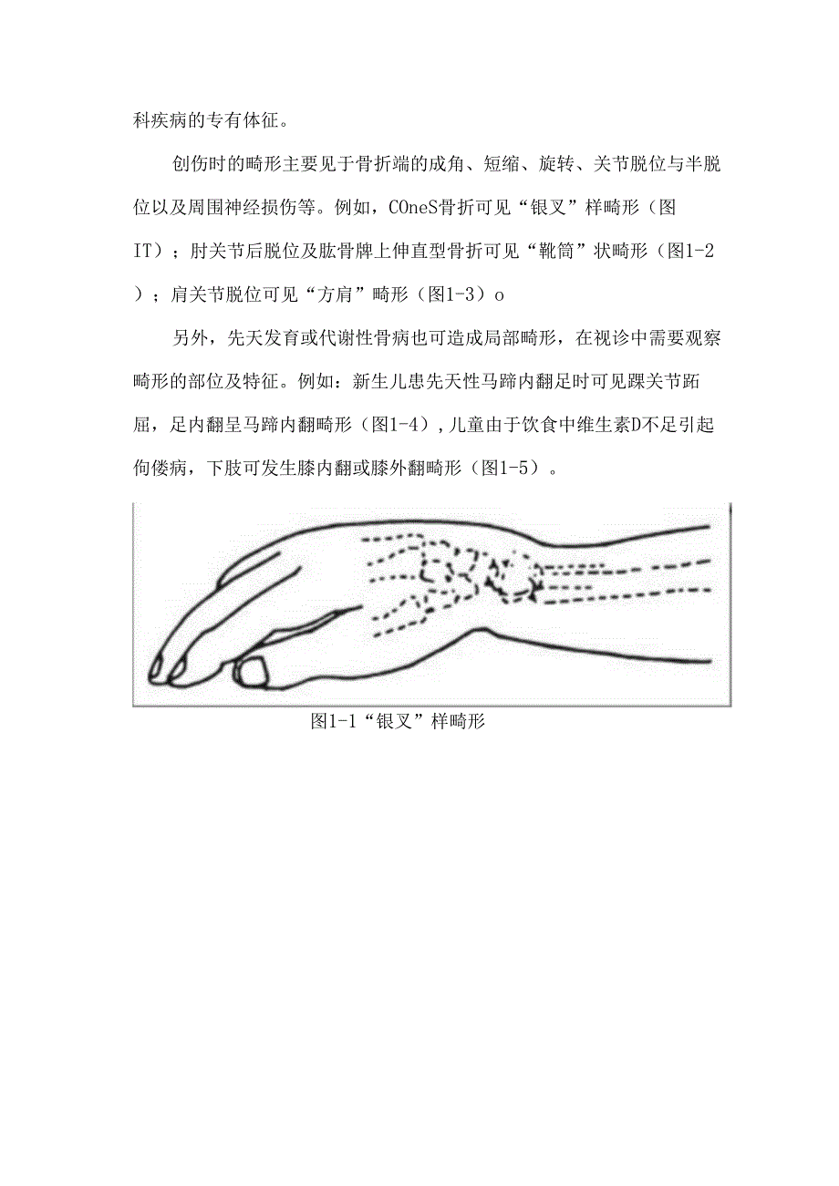 临床必备骨科常用体格检查.docx_第3页