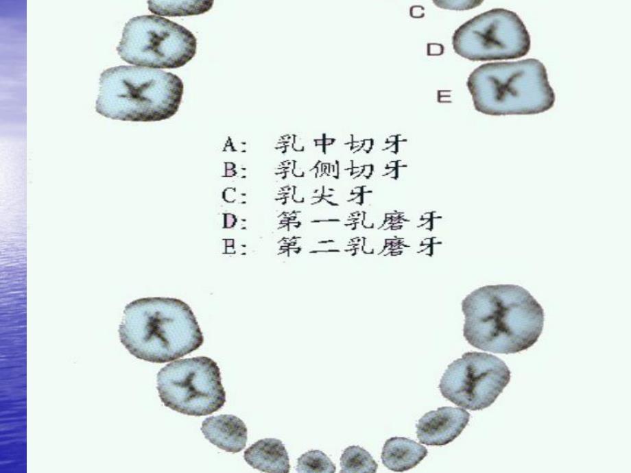 幼儿园龋齿PPT课件幼儿园龋齿PPT课件.ppt_第3页